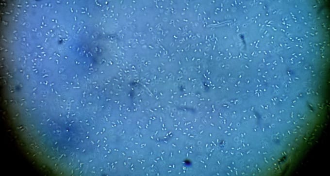 Almost all the bacteria you can see here are lactobacilli. These are cousins of the bacteria that turn milk into yogurt and cheese. These lactobacilli outnumber yeasts in sourdough by as many as 100 to one and the acids they make gives sourdough its flavour.