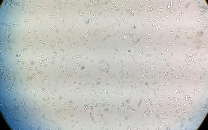 The most commonly used yeast species in the production of sourdough are Kazachstania exigua, Saccharomyces cerevisiae, and Candida humbles - this one is Saccharomyces cerevisiae, otherwise known as bakers yeast.